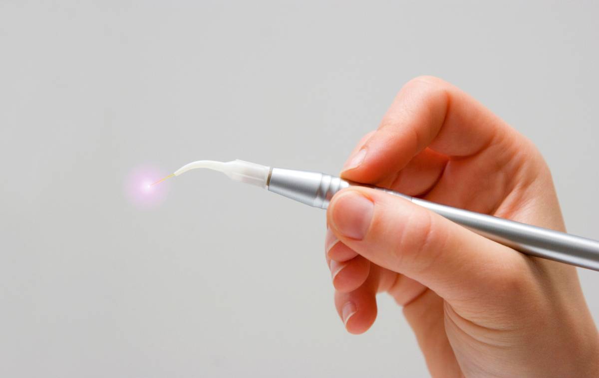 featured image for article about laser use in dentistry