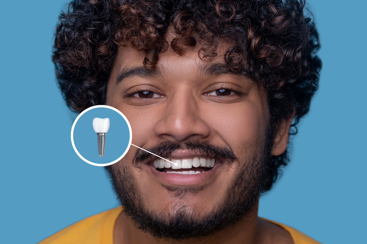 The image shows a young man smiling and showing off his realistic dental implant. The image represents how to care for dental implants.